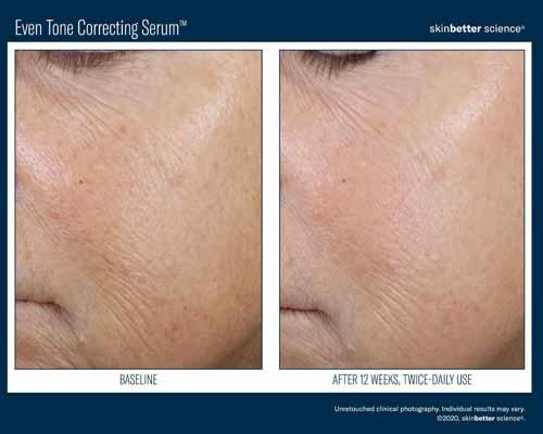 Flawless MedSpa after — Las Vegas, NV