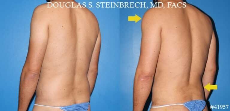 Gotham Plastic Surgery result — New York, NY