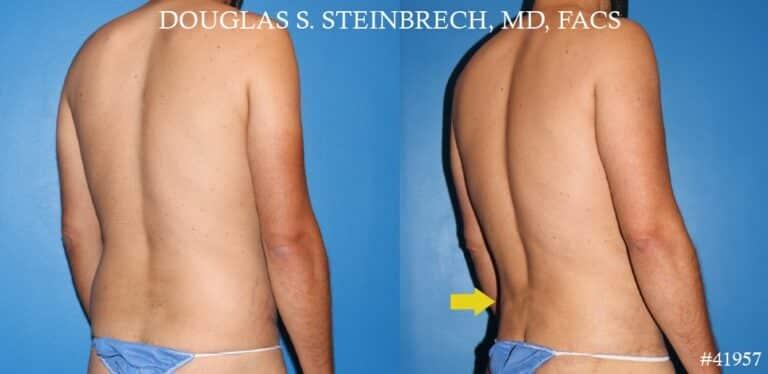 Gotham Plastic Surgery result — New York, NY