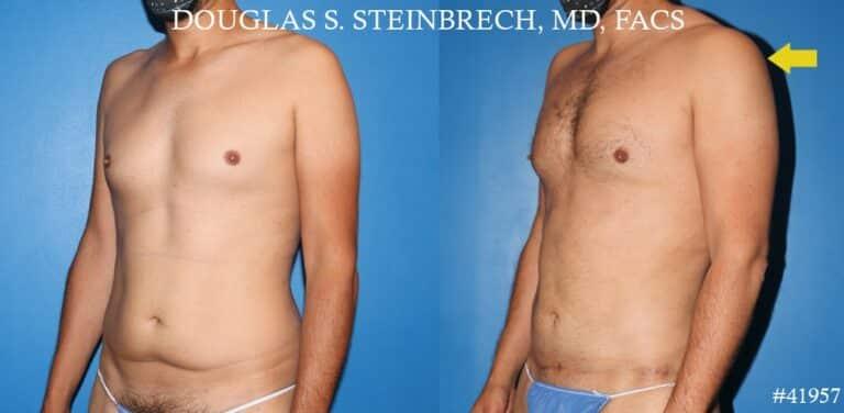 Gotham Plastic Surgery result — New York, NY