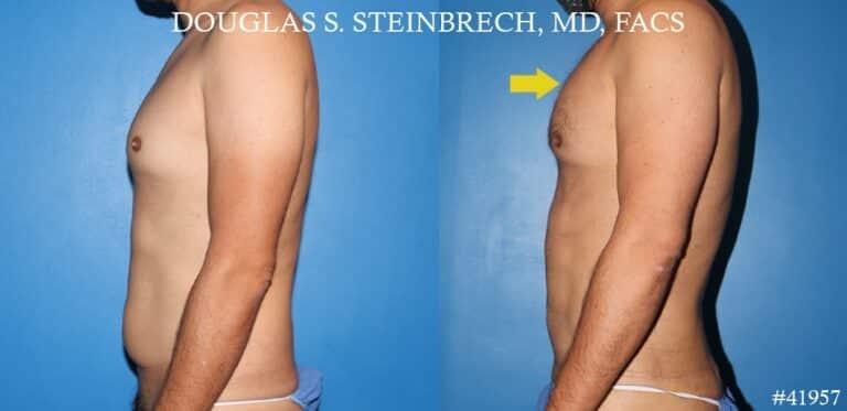Gotham Plastic Surgery result — New York, NY