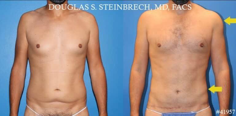Gotham Plastic Surgery result — New York, NY