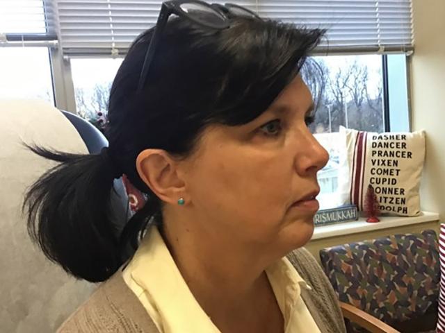 Neck Lift before at Mary Ella Carter, MD in Washington, DC