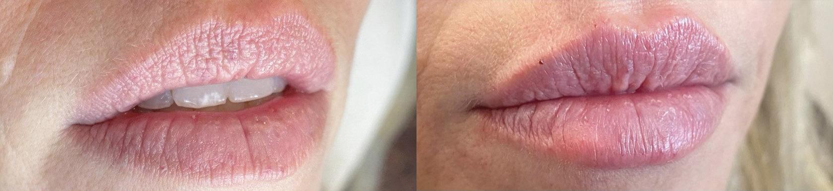 Metropolis Dermatology | Costa Mesa result — Costa Mesa, CA