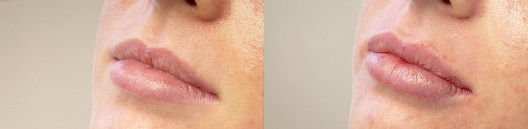 Metropolis Dermatology | Costa Mesa result — Costa Mesa, CA
