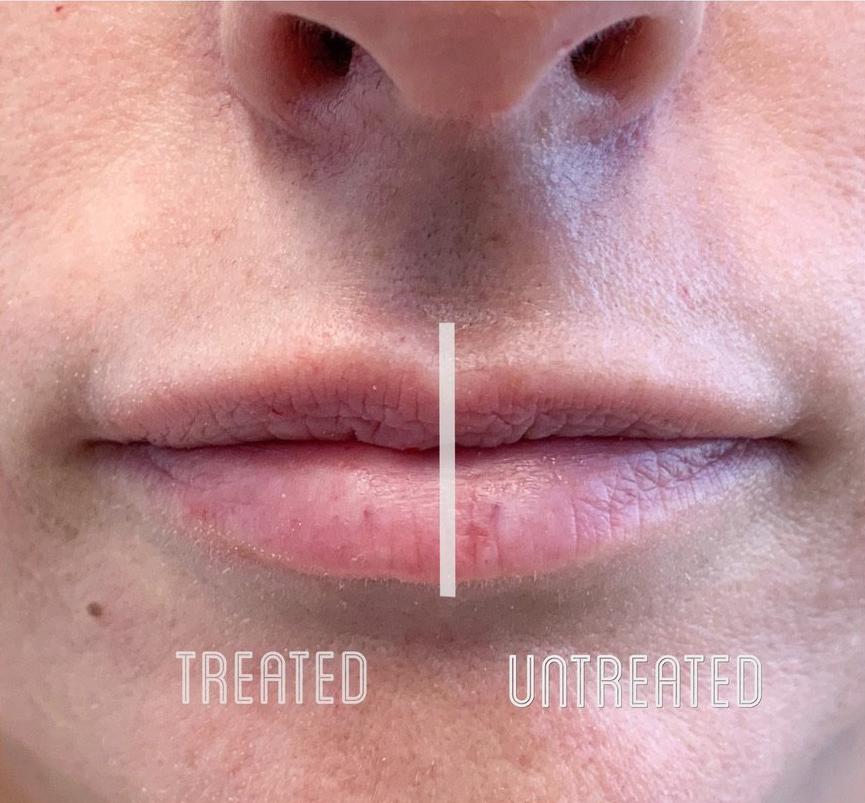 Metropolis Dermatology | Costa Mesa result — Costa Mesa, CA