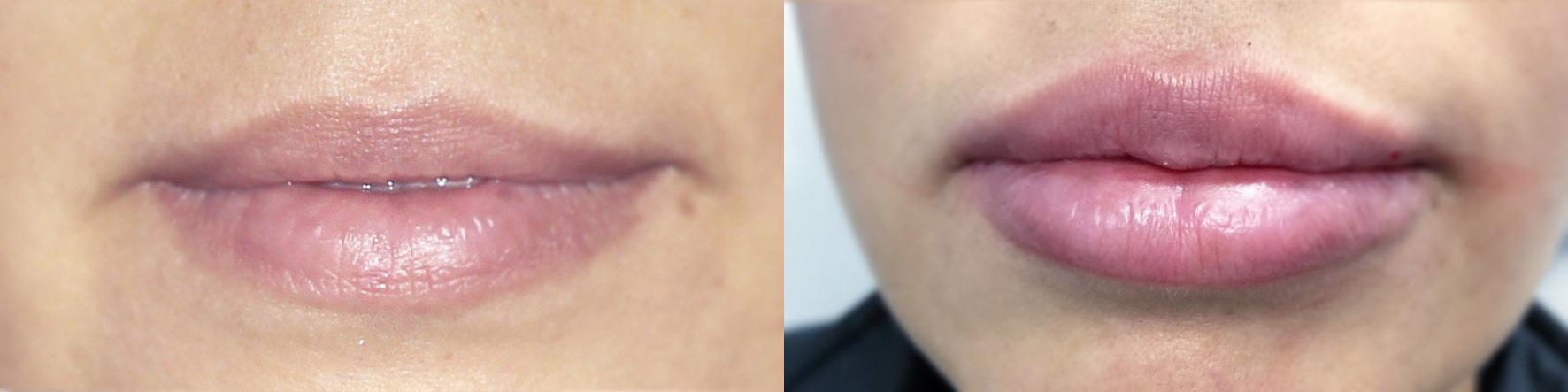Metropolis Dermatology | Costa Mesa result — Costa Mesa, CA
