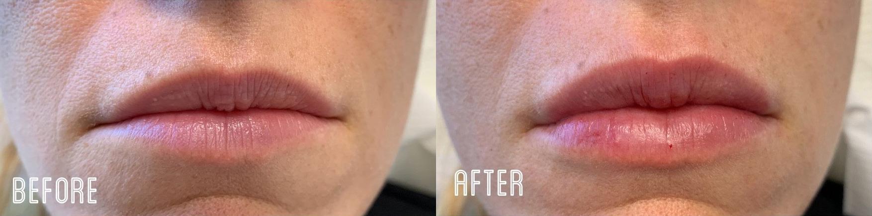 Metropolis Dermatology | Costa Mesa result — Costa Mesa, CA