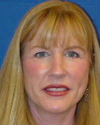 Dunedin Plastic Surgery (Jennifer B. Buck, MD) eyelid lift after — Dunedin, FL