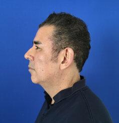 Los Angeles Plastic Surgery provider photo