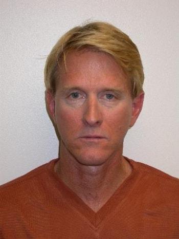 Facelift after at David A. Rosenstein, MD in Boynton Beach, FL