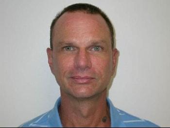 David A. Rosenstein, MD facelift after — Boynton Beach, FL