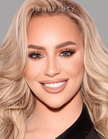 Dr. Salvator La Mastra V dental crowns after — Dallas, TX