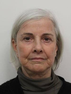 Petroff Center Plastic Surgery and Medi-Spa lip lift after — Lake Oswego, OR