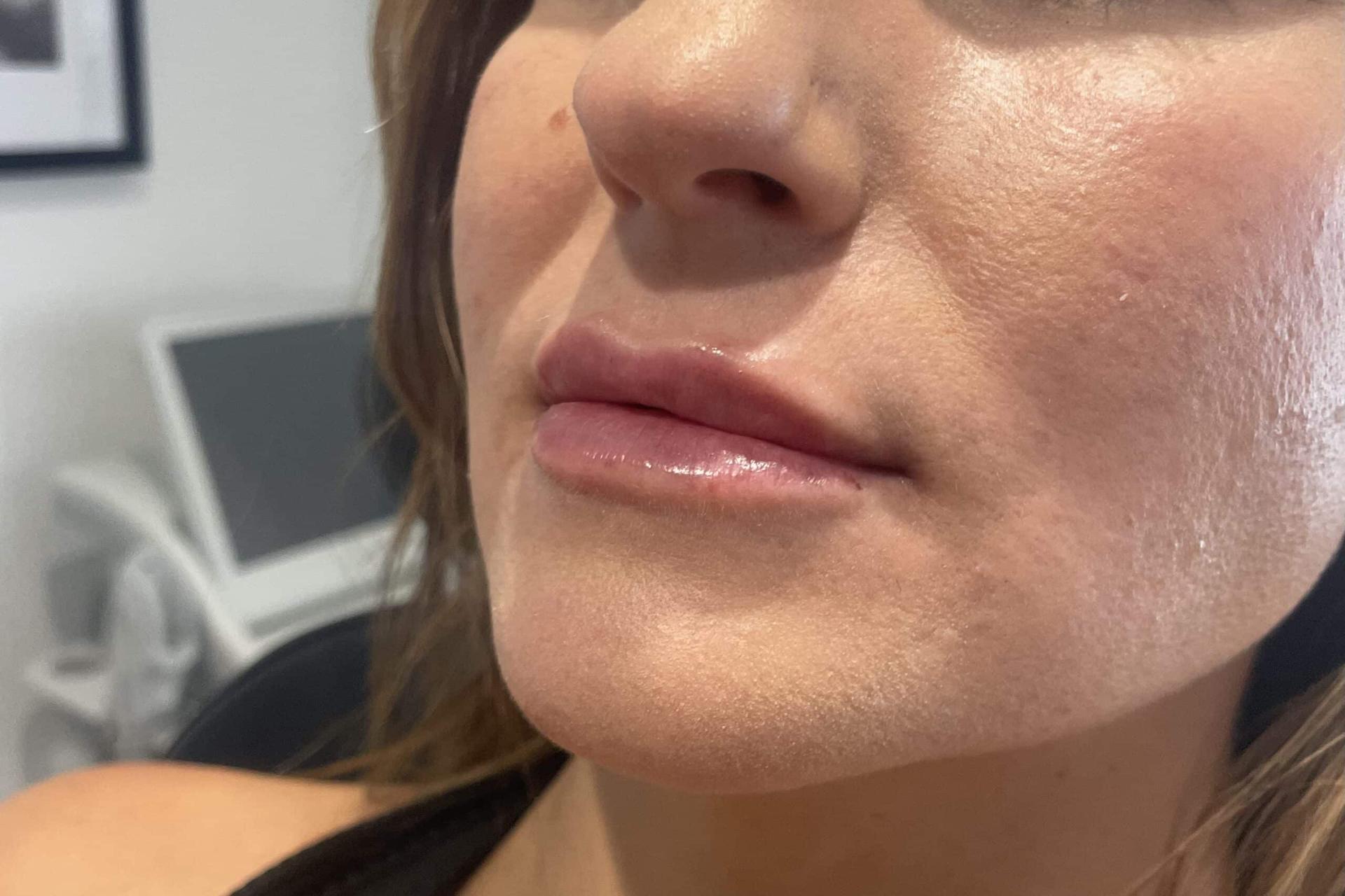 San Diego Aesthetics and Med Spa after — La Mesa, CA