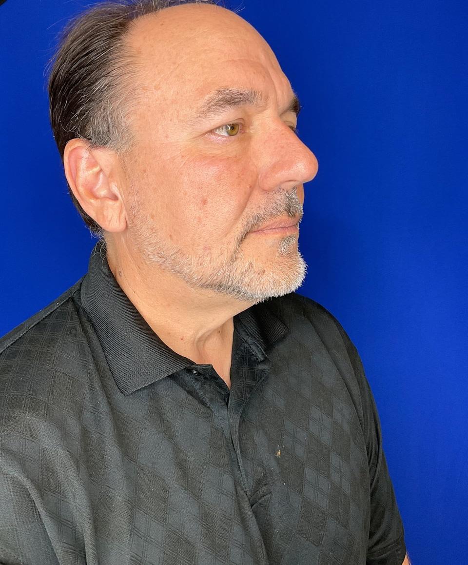 San Diego Aesthetics and Med Spa after — La Mesa, CA