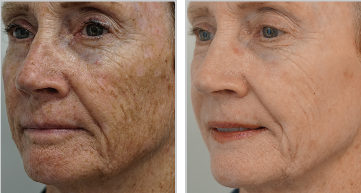 Epiphany Clinic result — American Fork, UT