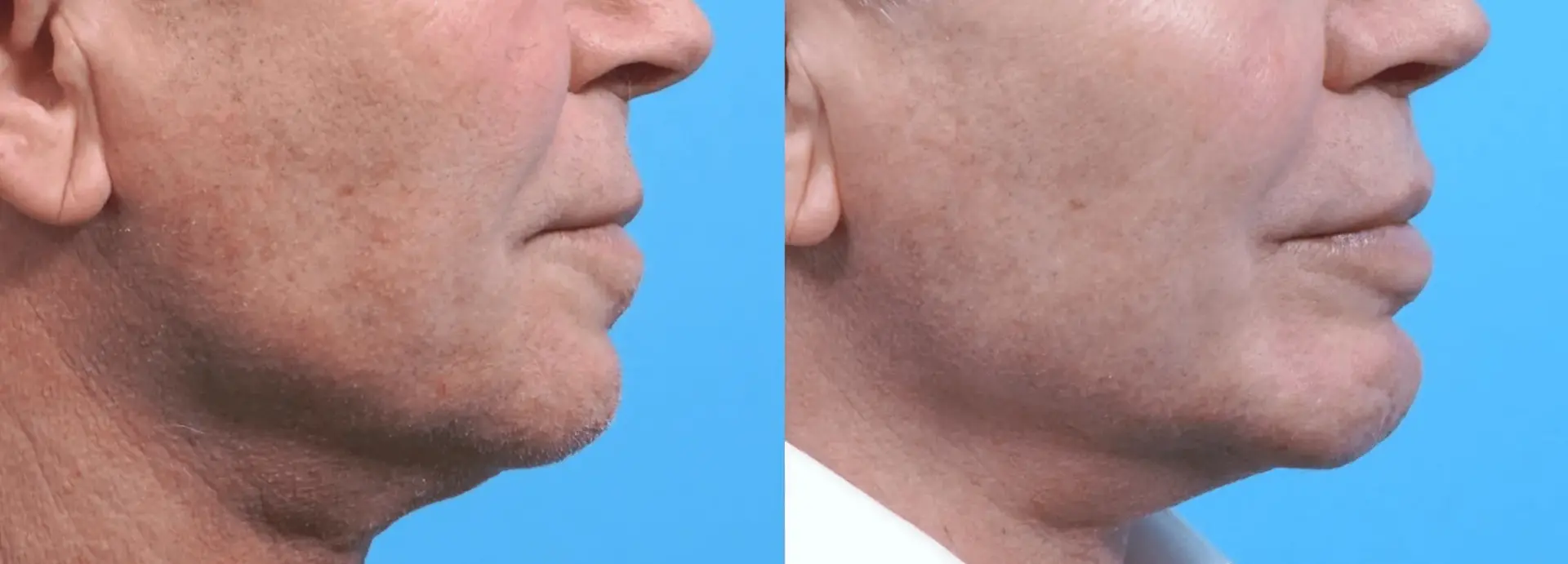 FORM DERM SPA result — Cottonwood Heights, UT