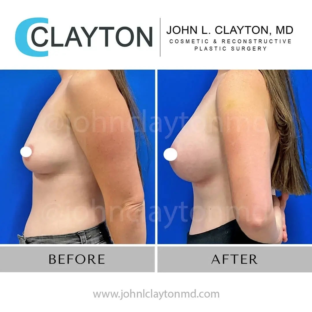 John L Clayton MD result — Riverton, UT