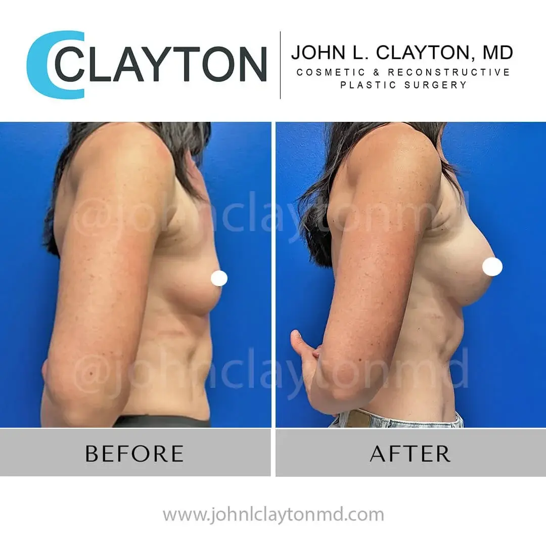 John L Clayton MD result — Riverton, UT