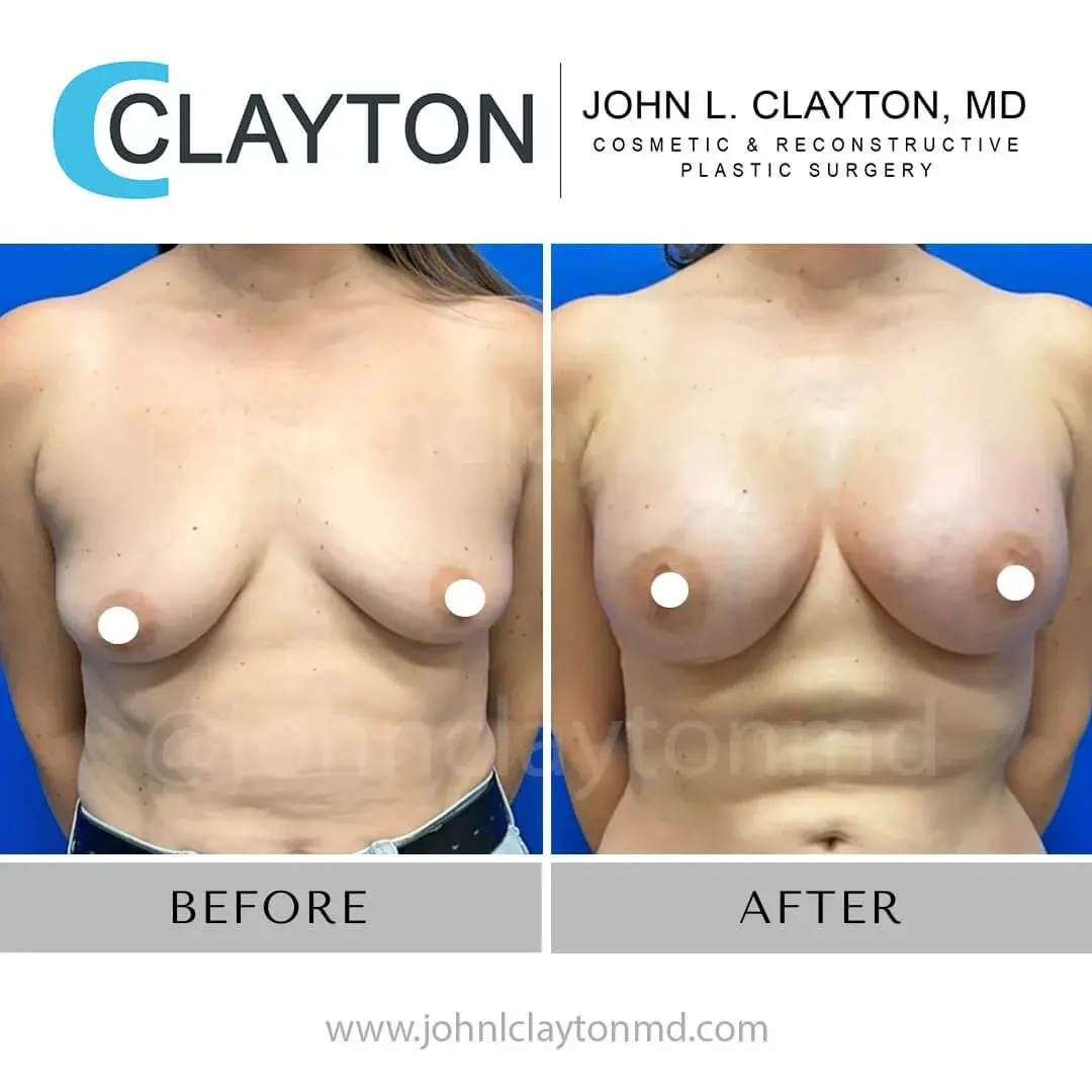 John L Clayton MD result — Riverton, UT