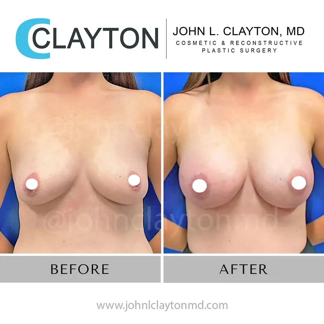 John L Clayton MD result — Riverton, UT