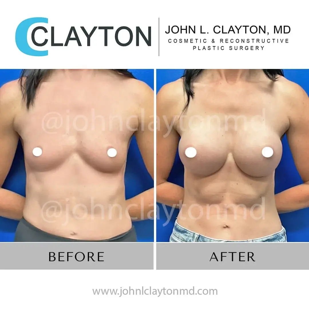 John L Clayton MD result — Riverton, UT