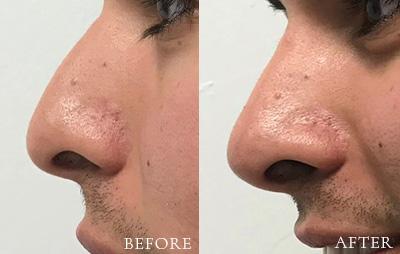 Xage Medical Spa result — Provo, UT