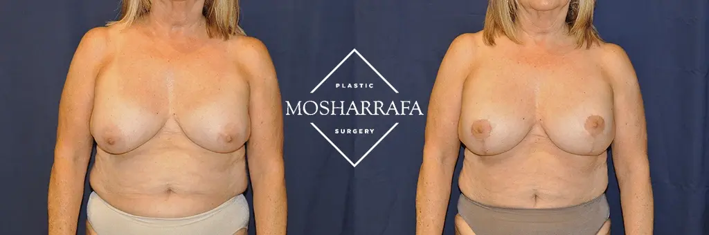 Tamir Mosharrafa, MD result — Phoenix, AZ