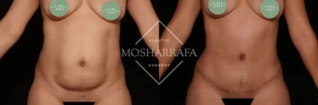 Tamir Mosharrafa, MD result — Phoenix, AZ