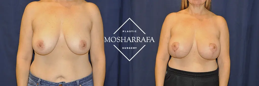 Tamir Mosharrafa, MD result — Phoenix, AZ