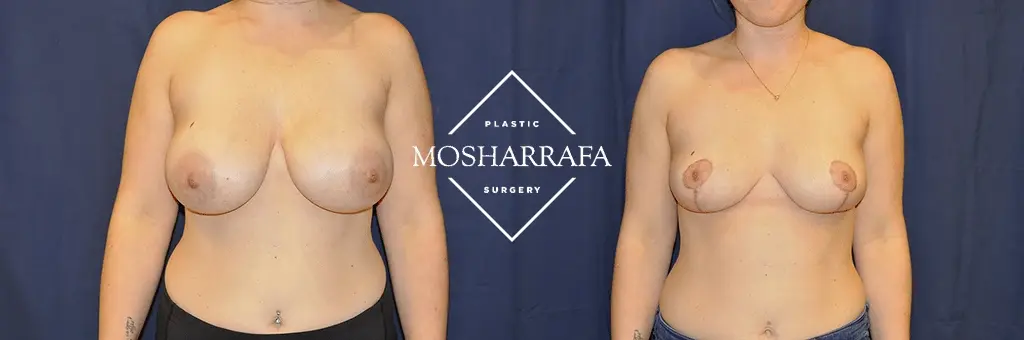 Tamir Mosharrafa, MD result — Phoenix, AZ