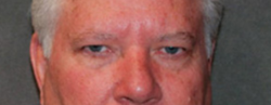 Lohner Plastic Surgery blepharoplasty result — Bryn Mawr, PA