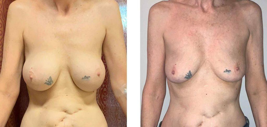 Whitlock Cosmetic Center of Oklahoma result — Tulsa, OK