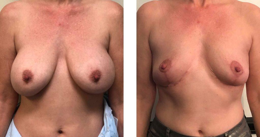 Whitlock Cosmetic Center of Oklahoma result — Tulsa, OK