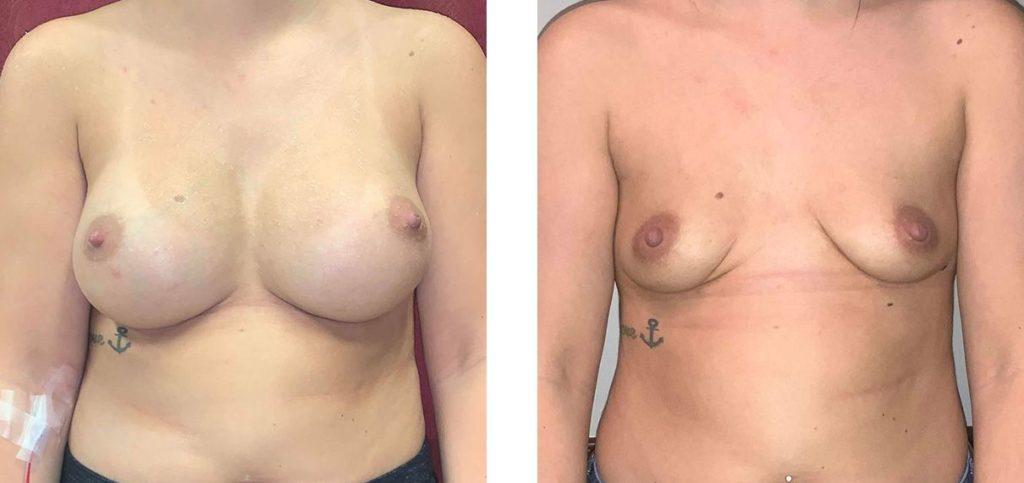 Whitlock Cosmetic Center of Oklahoma result — Tulsa, OK