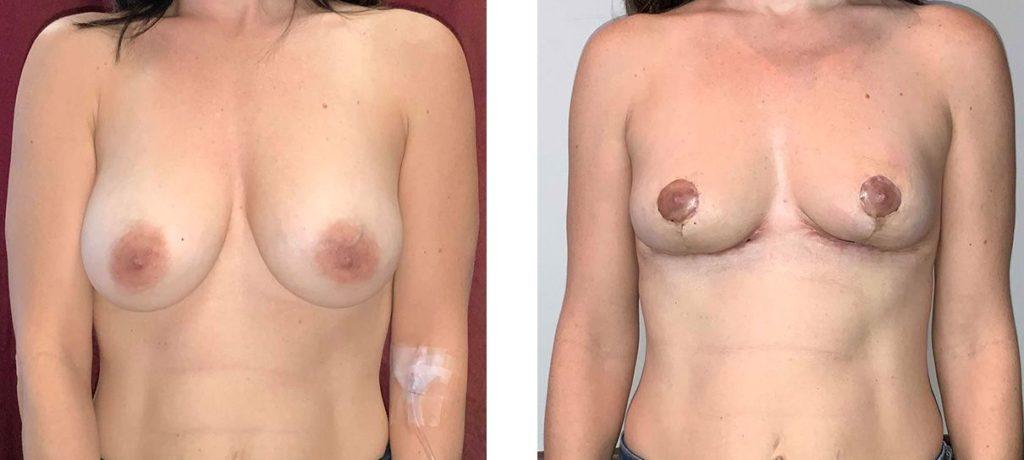 Whitlock Cosmetic Center of Oklahoma result — Tulsa, OK