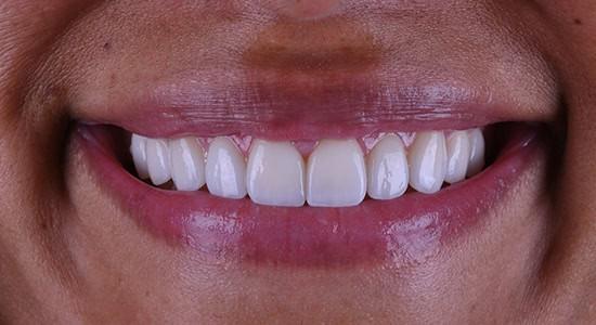 Carlsbad Beach Dental - Drew Addy, DDS provider photo
