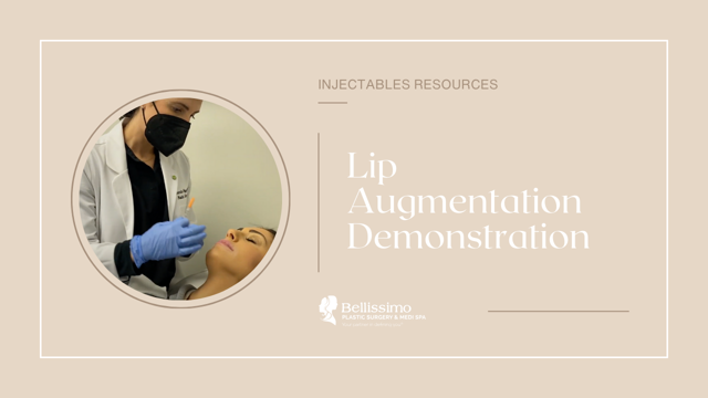 Lip Filler result at Bellissimo Plastic Surgery & Medi Spa in Pittsburgh, PA