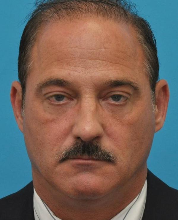 Baltimore-Washington Facial Plastic Surgery & Medical Spa: Thomas T. Le, MD provider photo