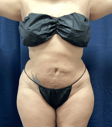 Zelko Aesthetics after — Greenfield, WI