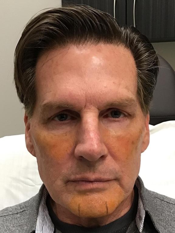 Zelko Aesthetics after — Greenfield, WI