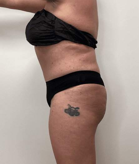 Zelko Aesthetics after — Greenfield, WI