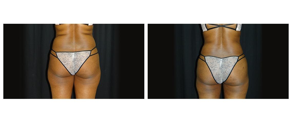 Associates in Plastic Surgery bbl result — Virginia Beach, VA