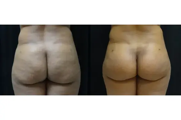 Associates in Plastic Surgery bbl result — Virginia Beach, VA