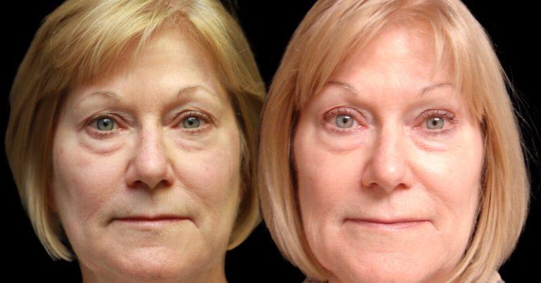 Associates in Plastic Surgery result — Virginia Beach, VA