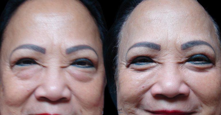 Associates in Plastic Surgery result — Virginia Beach, VA