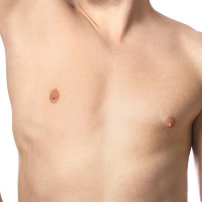 Spa Trouve hair restoration after — St. George, UT