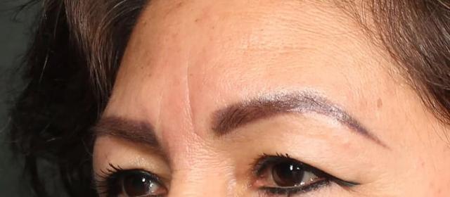 Blepharoplasty before at Dr. William Harris - Harris Facial Plastic Surgery & Aesthetics in Beverly Hills, CA