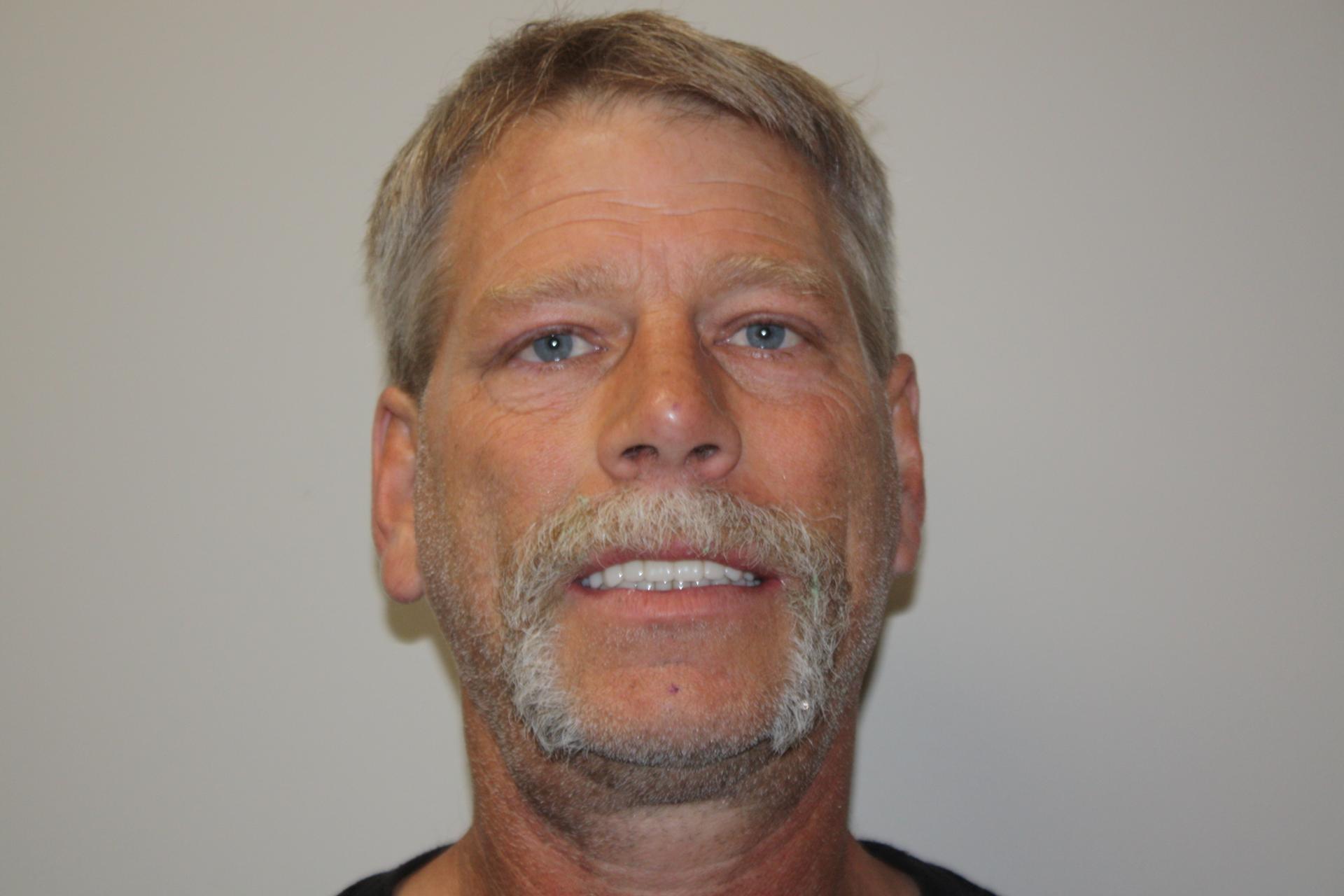 North County Cosmetic and Implant Dentistry smile makeover after — Vista, CA